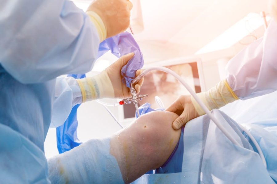 Αρθροσκόπηση γόνατος - Δρ. Ελευθέριος Καραδήμας Ορθοπεδικός Χειρουργός