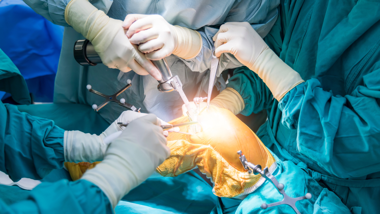 Οστεοαρθρίτιδα γόνατος: Διάγνωση & Χειρουργική Θεραπεία - Δρ. Ελευθέριος Καραδήμας Ορθοπεδικός Χειρουργός